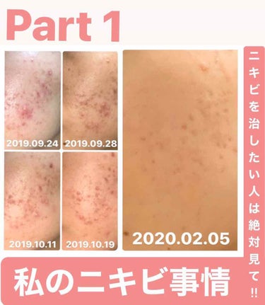 いちごあめ🍓 on LIPS 「こんにちは☺︎いちごあめ🍓です‼︎初投稿です😅酷すぎる私のニキ..」（1枚目）