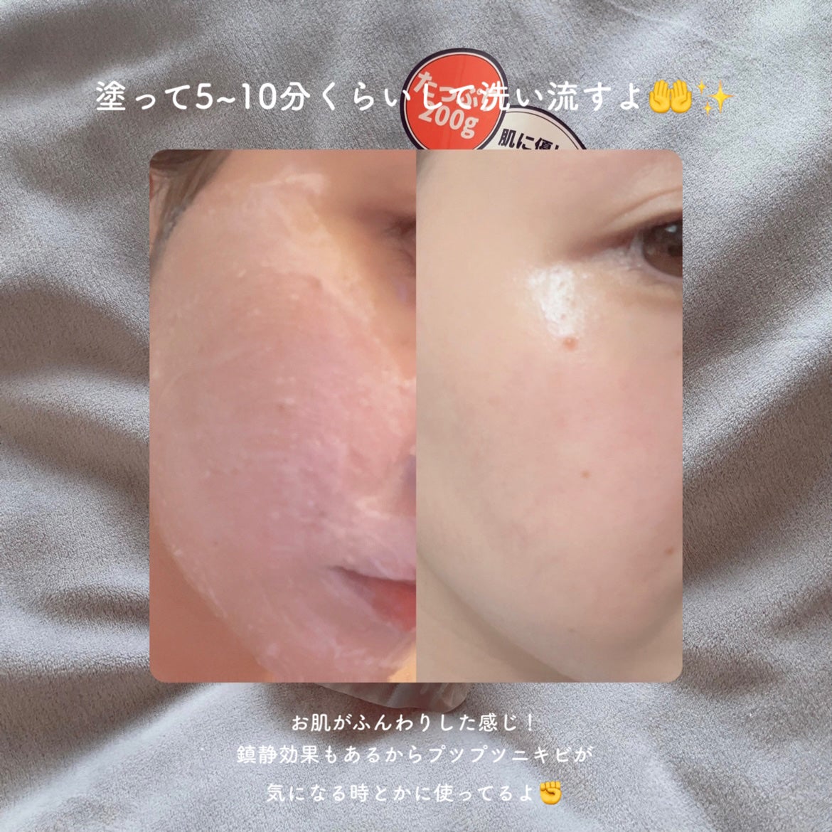 ピンクティーツリーライスシカウォッシュオフパック/APLIN/洗い流すパック・マスクを使ったクチコミ(3枚目)