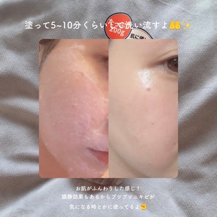 ピンクティーツリーライスシカウォッシュオフパック/APLIN/洗い流すパック・マスクを使ったクチコミ(3枚目)