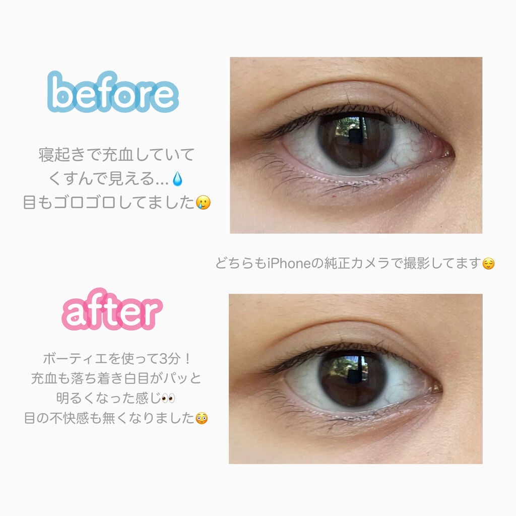 サンテ ボーティエ コンタクト(医薬品)/参天製薬/その他を使ったクチコミ(2枚目)