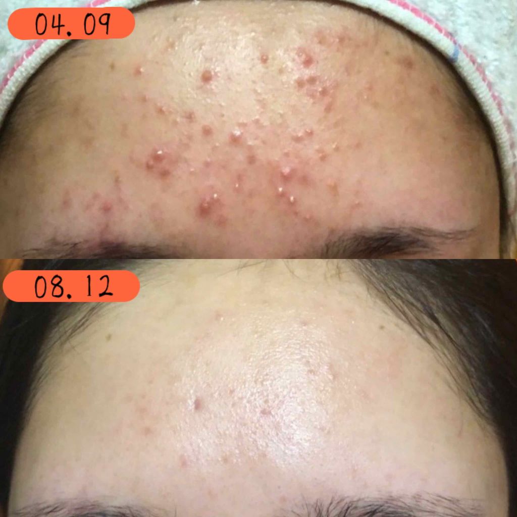 ウオーター/アベンヌ/ミスト状化粧水を使ったクチコミ(3枚目)