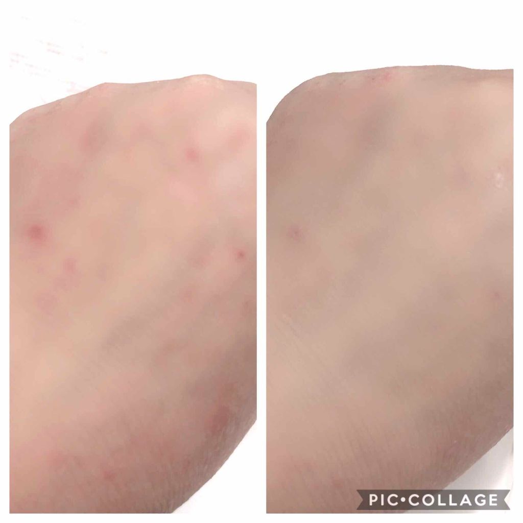 スキントリートメント ファンデーション/ナチュラグラッセ/リキッドファンデーションを使ったクチコミ（2枚目）