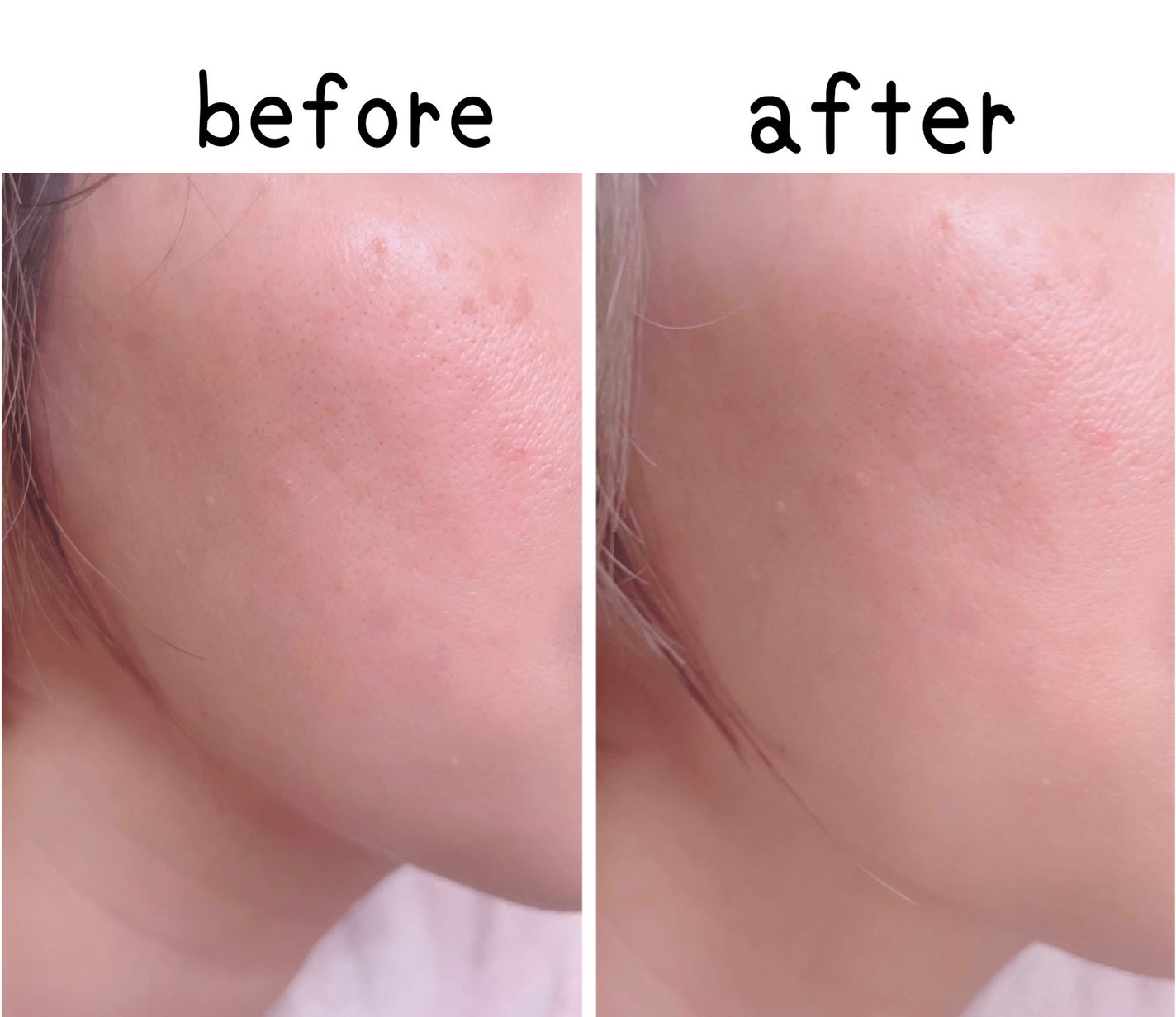 ドクタージー ブラックスネイル コラーゲンミスト/Dr.G/ミスト状化粧水を使ったクチコミ(8枚目)