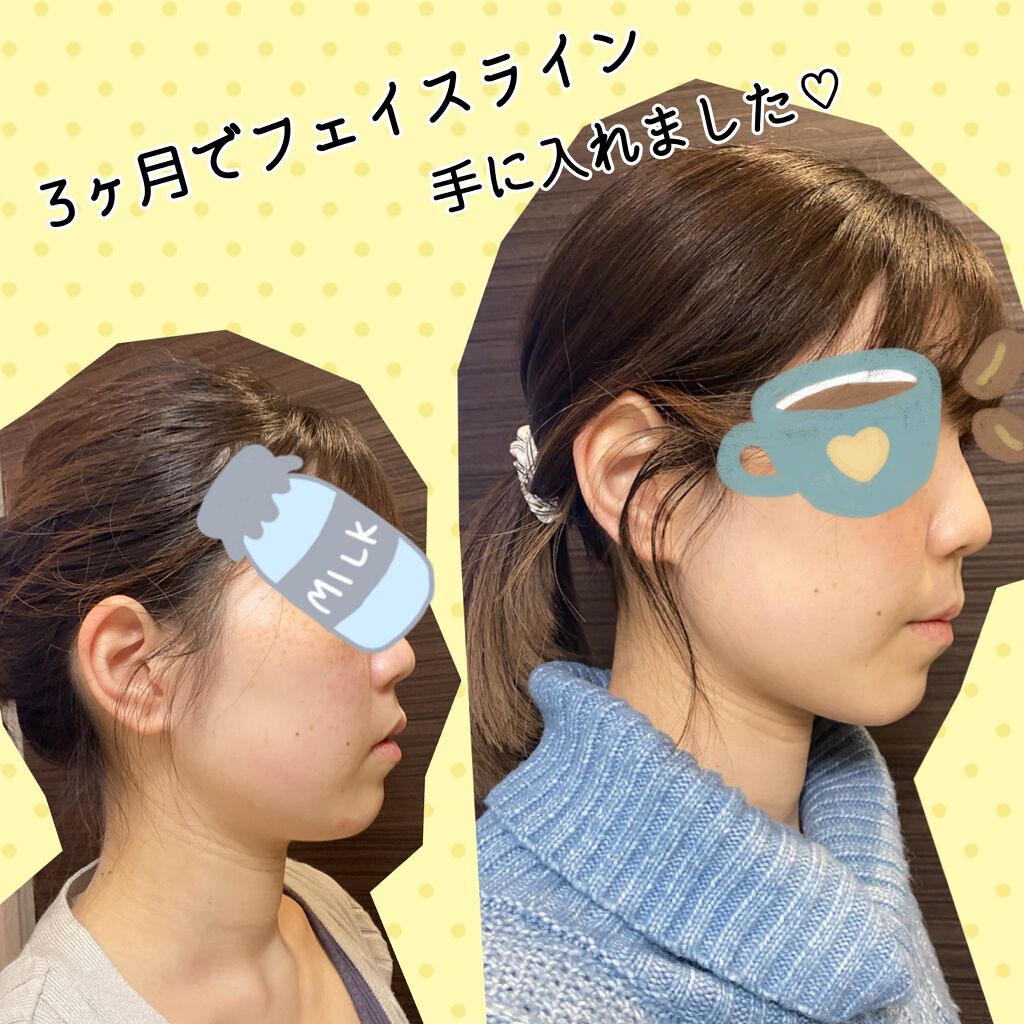 DHC はとむぎエキス/DHC/健康サプリメントを使ったクチコミ（1枚目）