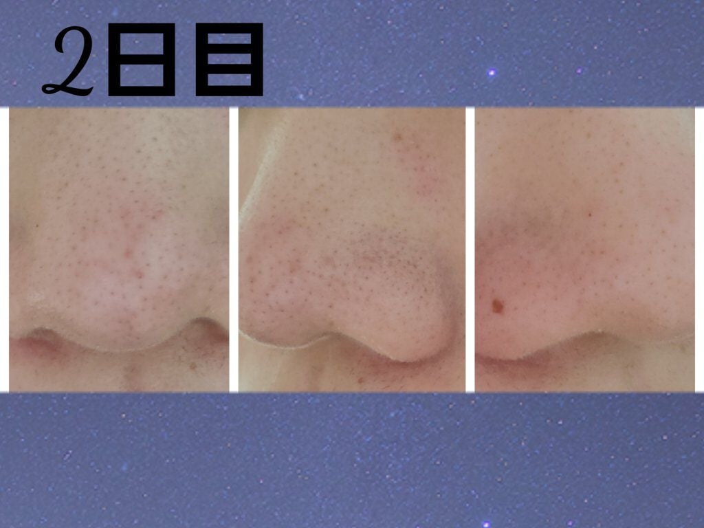 お米のマスク/毛穴撫子/シートマスク・パックを使ったクチコミ(6枚目)