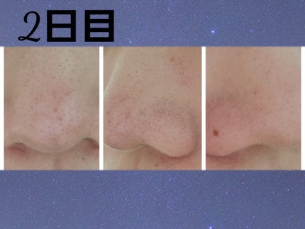 お米のマスク/毛穴撫子/シートマスク・パックを使ったクチコミ(6枚目)