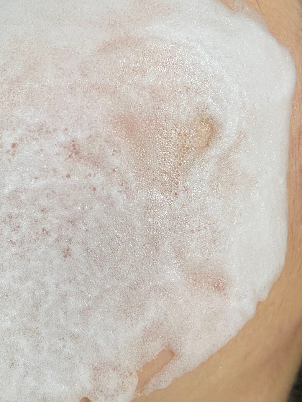 マジックバブルエッセンスパックMINI/BAKER7/シートマスク・パックを使ったクチコミ(2枚目)