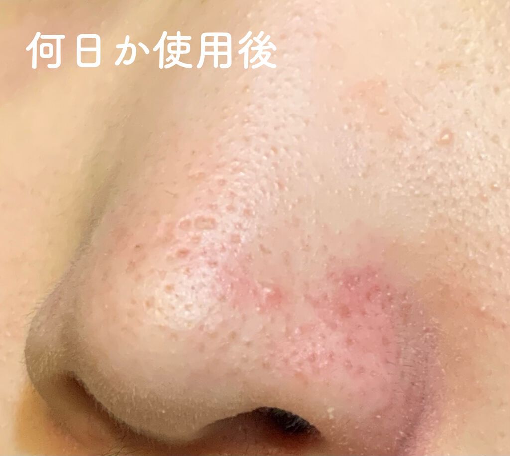 エマルジョンリムーバー 300ml/200ml/水橋保寿堂製薬/その他洗顔料を使ったクチコミ(7枚目)