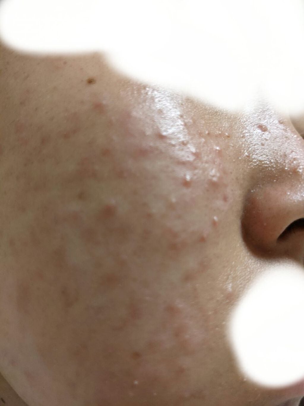 いやりんぐ on LIPS 「学校帰りの肌です。朝は「お!調子いいじゃん?」って思っても学校..」(4枚目)