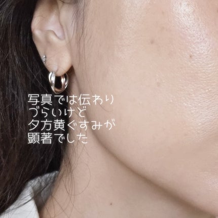 プレミアムニードルファンデーション/ジュエリアプレミアム/クッションファンデーションを使ったクチコミ(10枚目)