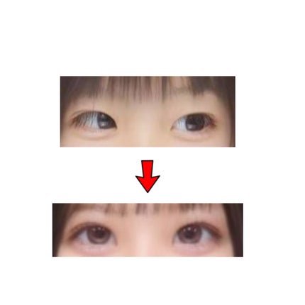 オリシキ アイリッドスキンフィルム /D-UP/二重まぶた用アイテムを使ったクチコミ(2枚目)