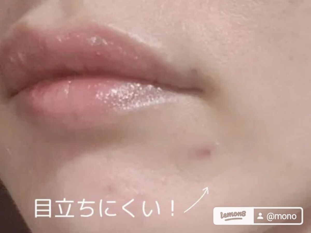 ティーツリーカーミングスポットパッチ/MEDIHEAL/その他スキンケアを使ったクチコミ（2枚目）