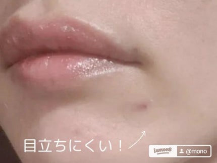 ティーツリーカーミングスポットパッチ/MEDIHEAL/その他スキンケアを使ったクチコミ(2枚目)