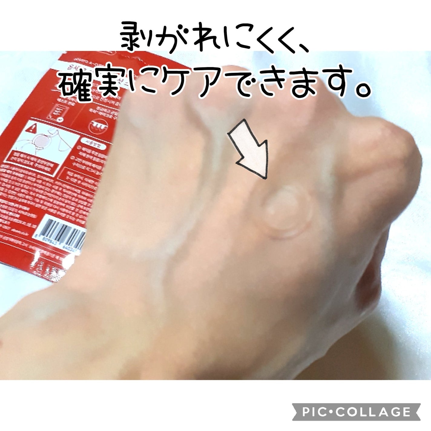 エーキュアショットスポットパッチ/obsero/にきびパッチを使ったクチコミ(7枚目)