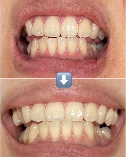 look ð€ãã©ãã100 on LIPS ãâ¶ïžå€§äººæ°ã®è¬çšãã¯ã€ããã³ã°ðŠ·ãã³ã¿ã¯ã³ãã·ãªãŒãºè²©å£²çޝèš5..ãïŒ7æç®ïŒ