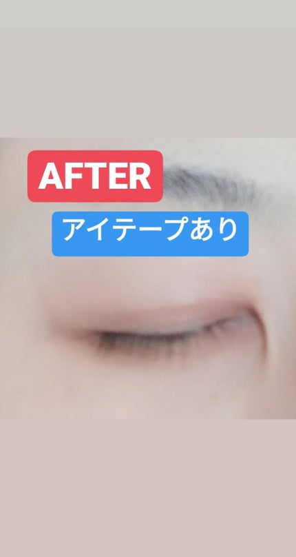 のびるアイテープ/キャンドゥ/二重まぶた用アイテムを使ったクチコミ(3枚目)