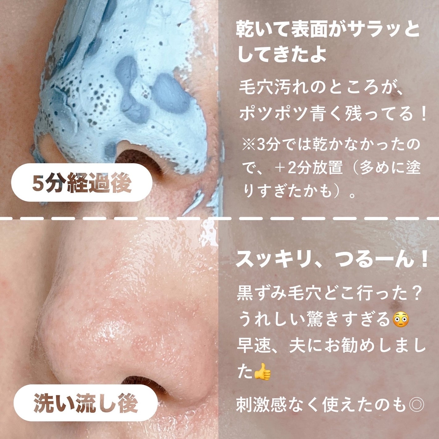 ゼロ毛穴クレイパック/MEDICUBE/洗い流すパック・マスクを使ったクチコミ(4枚目)