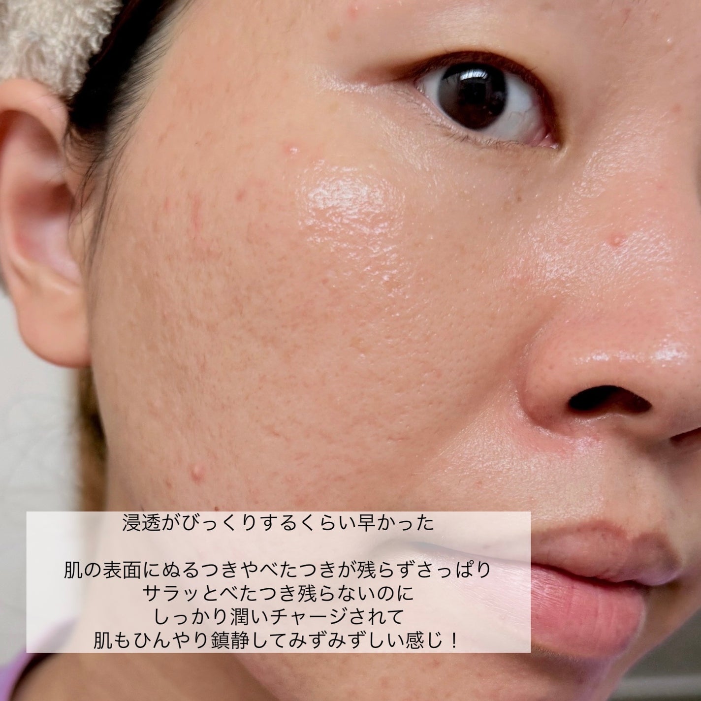 クリアエッセンスマスク/ピュレア/シートマスク・パックを使ったクチコミ(6枚目)