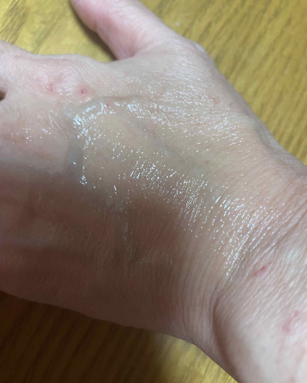 イグニス イオ フローラル バーム/IGNIS/リップバームを使ったクチコミ(6枚目)