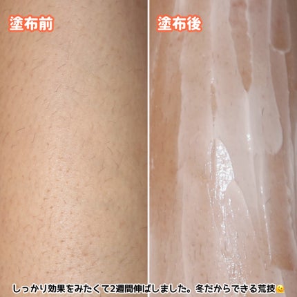 パイナップル豆乳除毛クリーム/鈴木ハーブ研究所/除毛クリームを使ったクチコミ(5枚目)