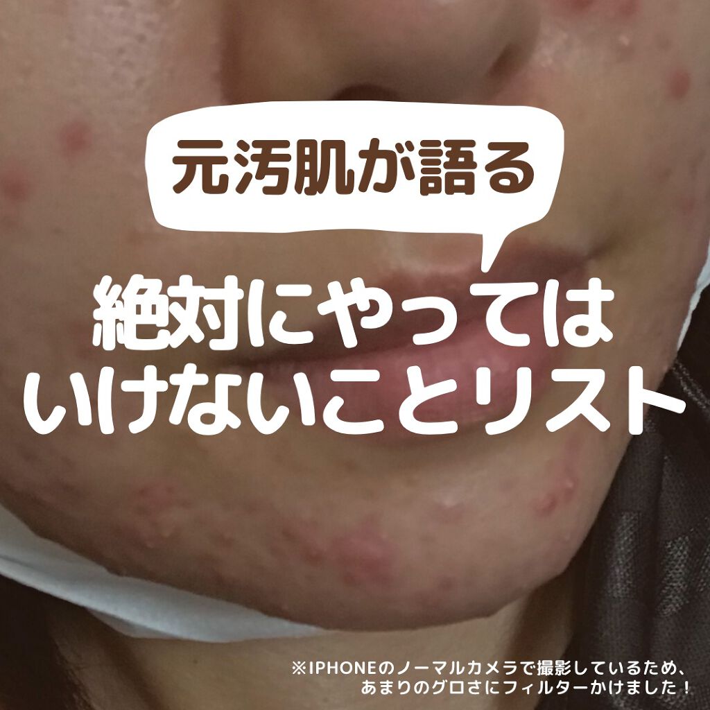 HPローション(医薬品)/ノバルティス ファーマ/その他を使ったクチコミ（1枚目）