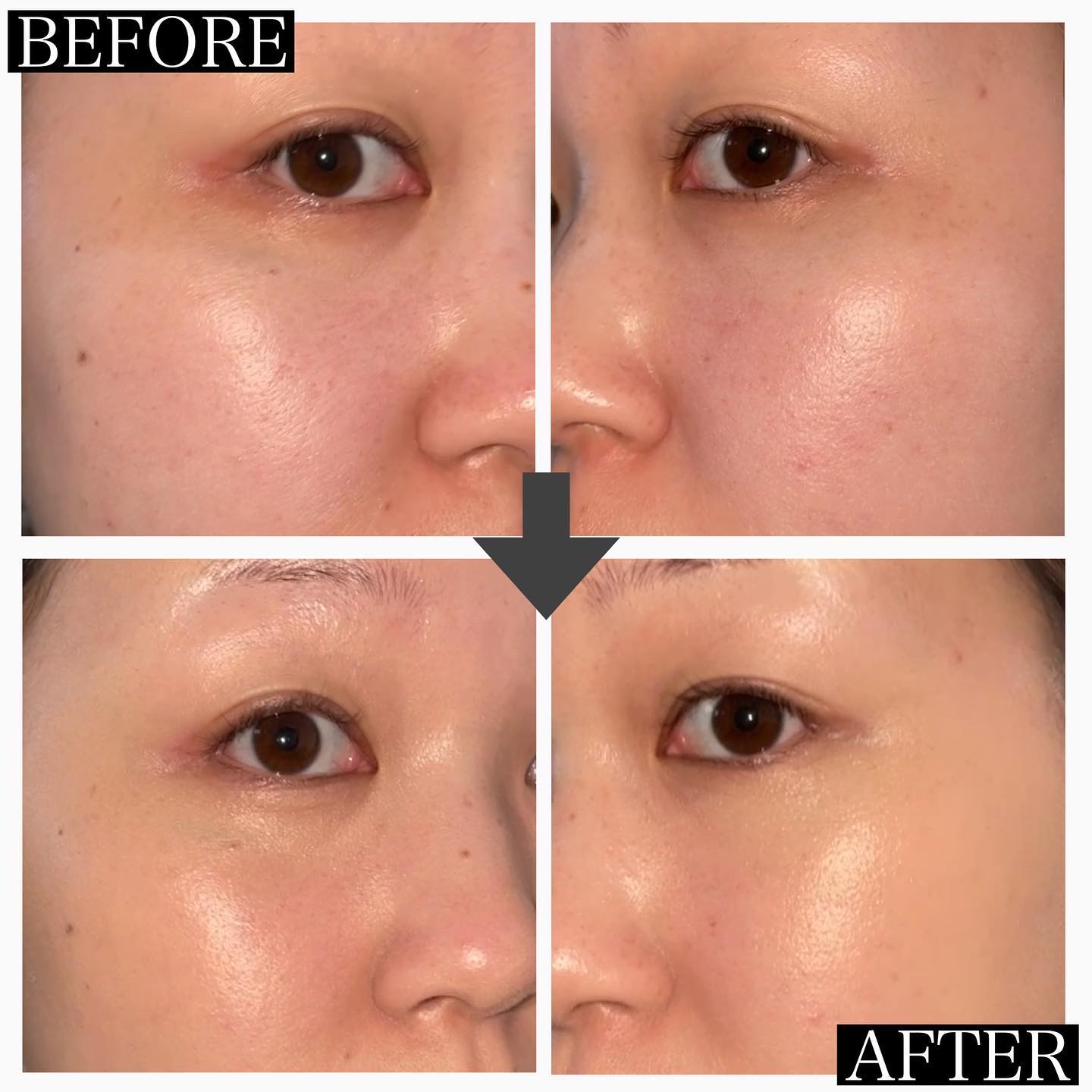 カーミンググロウアップクッションファンデーション/favs/リキッドファンデーションを使ったクチコミ（2枚目）