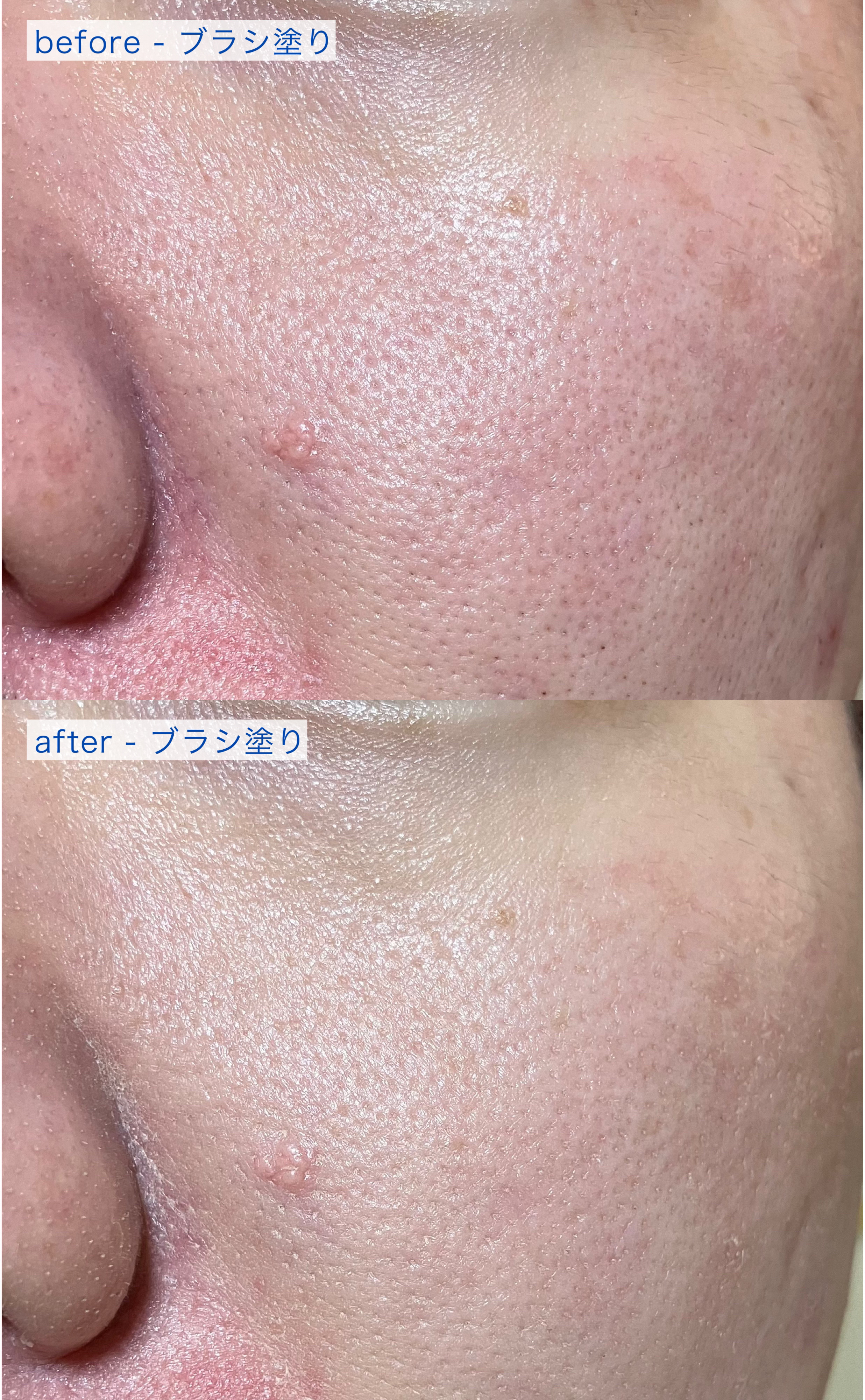 エッセンス スキングロウ ファンデーション/SHISEIDO/リキッドファンデーションを使ったクチコミ（3枚目）