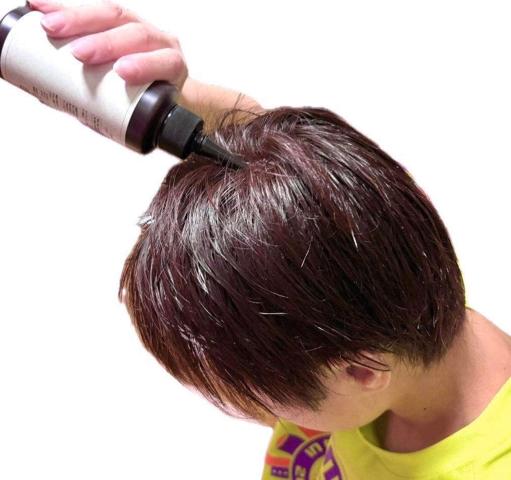 ナノグロウリッチ/iqumore/頭皮ローションを使ったクチコミ(5枚目)