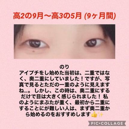 アイビューティー フィクサー WP/アストレア ヴィルゴ/二重まぶた用アイテムを使ったクチコミ(2枚目)