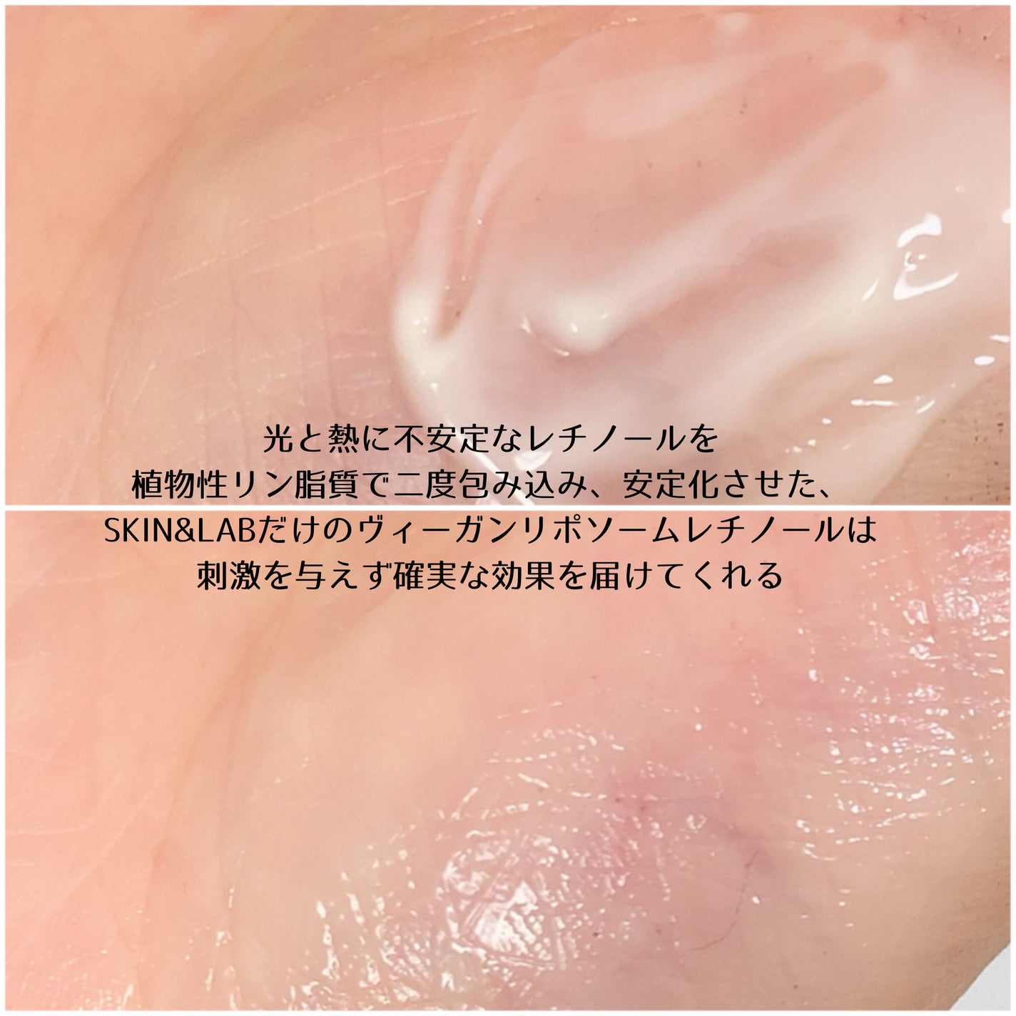 ヴィーガンリポソームレチノールセラム/SKIN&LAB/美容液を使ったクチコミ(2枚目)