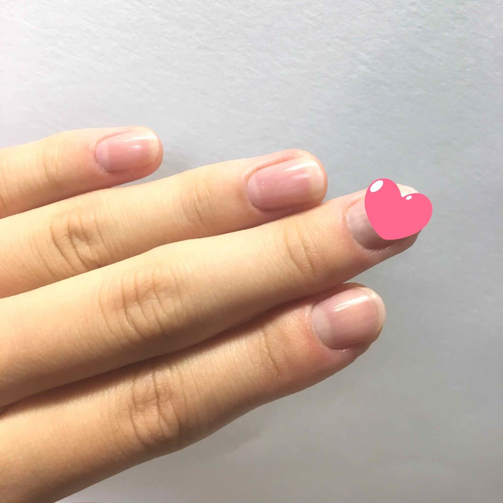 オールインケアコート/ネイリスト/オールインワンネイルを使ったクチコミ（3枚目）