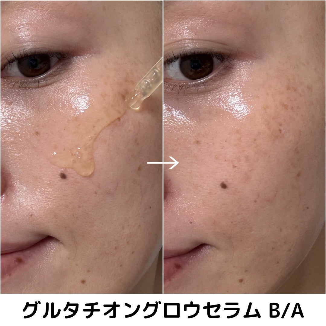 グルタチオングロウアンプル/MEDICUBE/美容液を使ったクチコミ(5枚目)