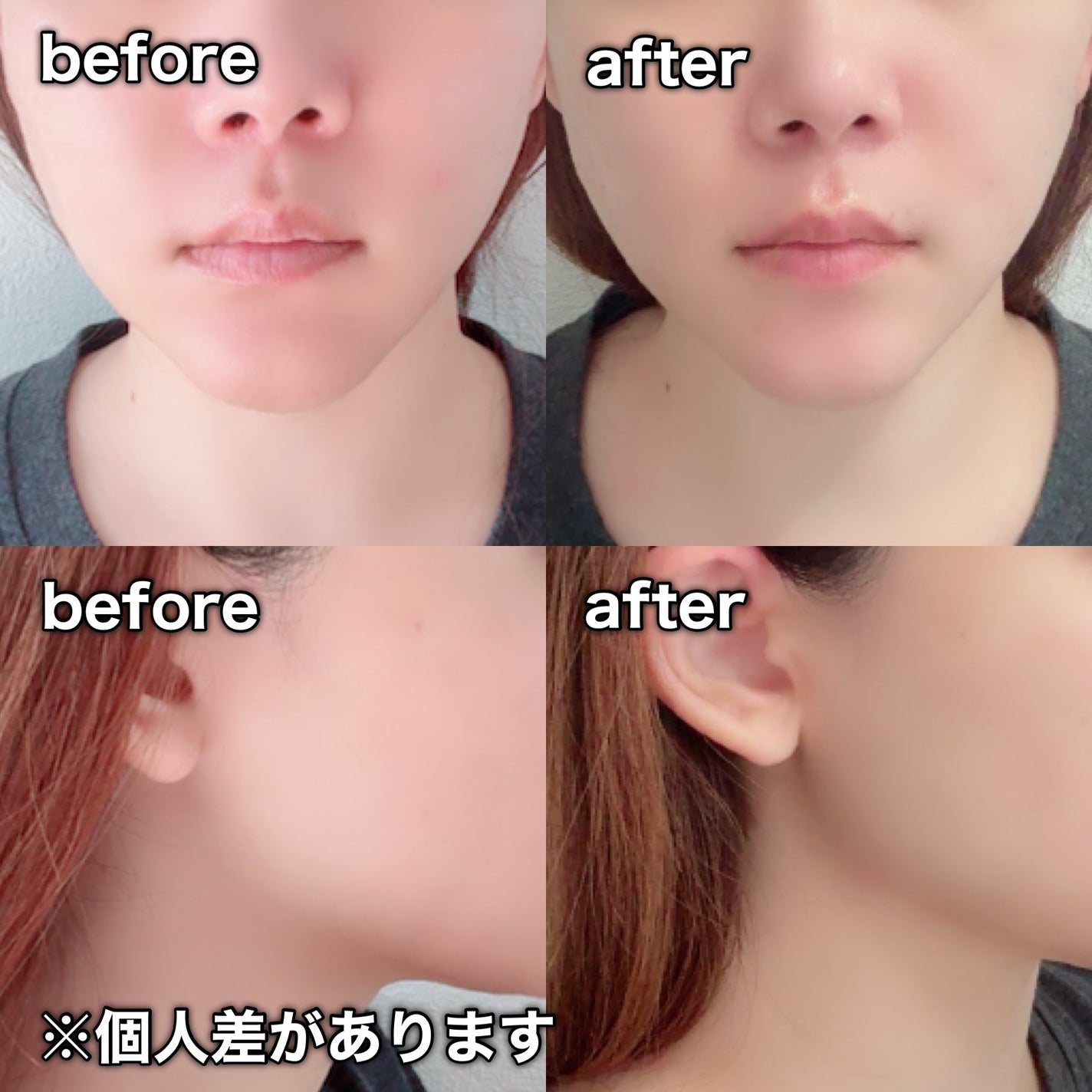 9番 NMNバイオリフトラッピングマスク/numbuzin/シートマスク・パックを使ったクチコミ(9枚目)