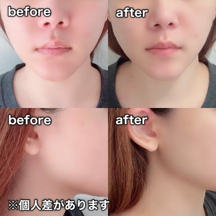 9番 NMNバイオリフトラッピングマスク/numbuzin/シートマスク・パックを使ったクチコミ(9枚目)