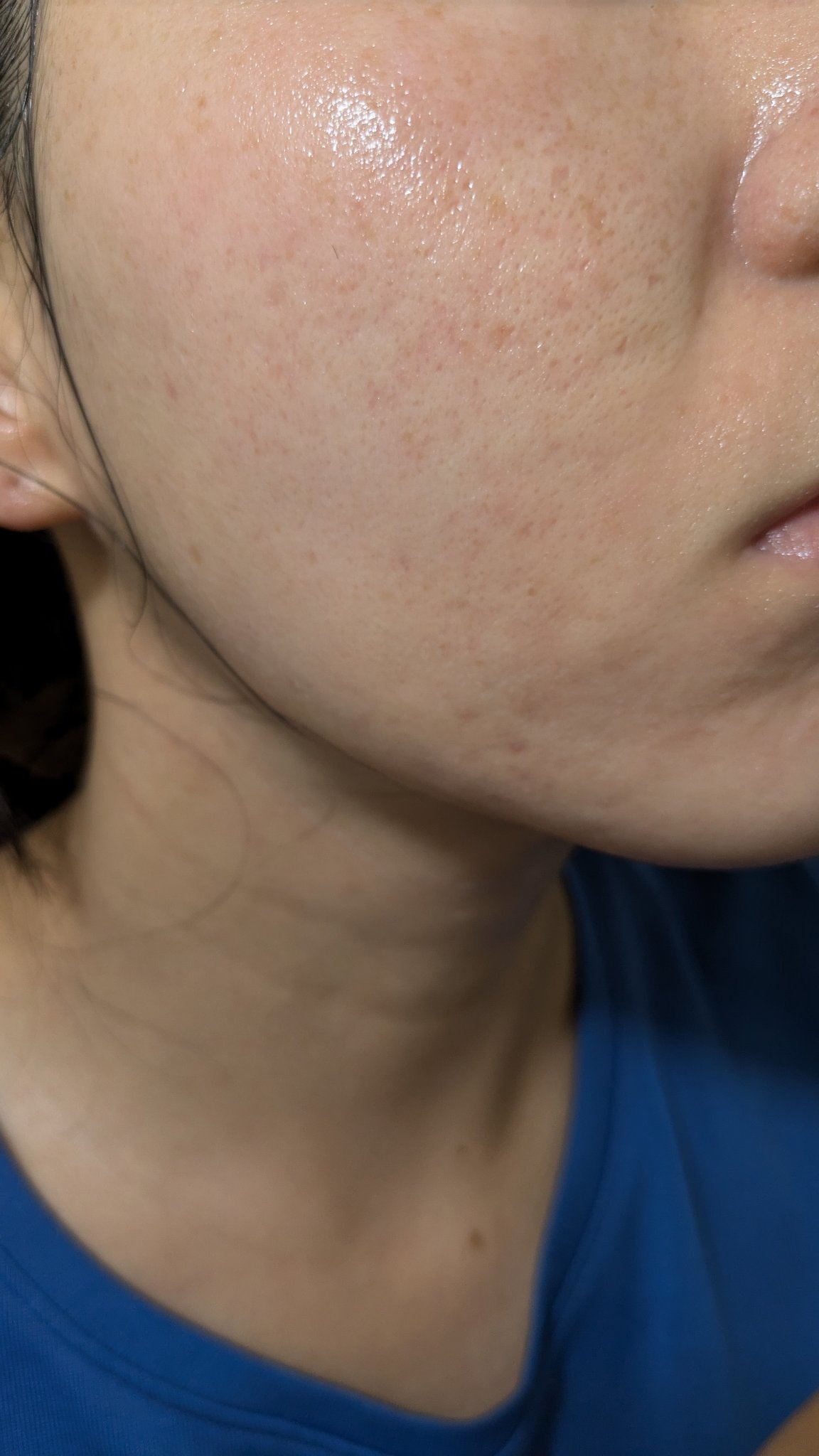 N10+Z1フェイスセラム /The Ordinary/美容液を使ったクチコミ（1枚目）