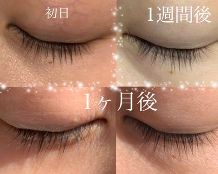 スカルプD ボーテ ピュアフリーアイラッシュセラム/アンファー(スカルプD)/まつげ美容液を使ったクチコミ(2枚目)