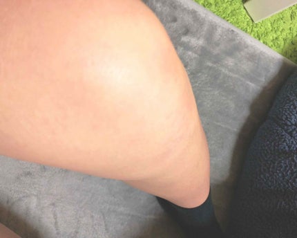 ジョンソンベビーオイル微香性/ジョンソンベビー/ボディオイルを使ったクチコミ(2枚目)