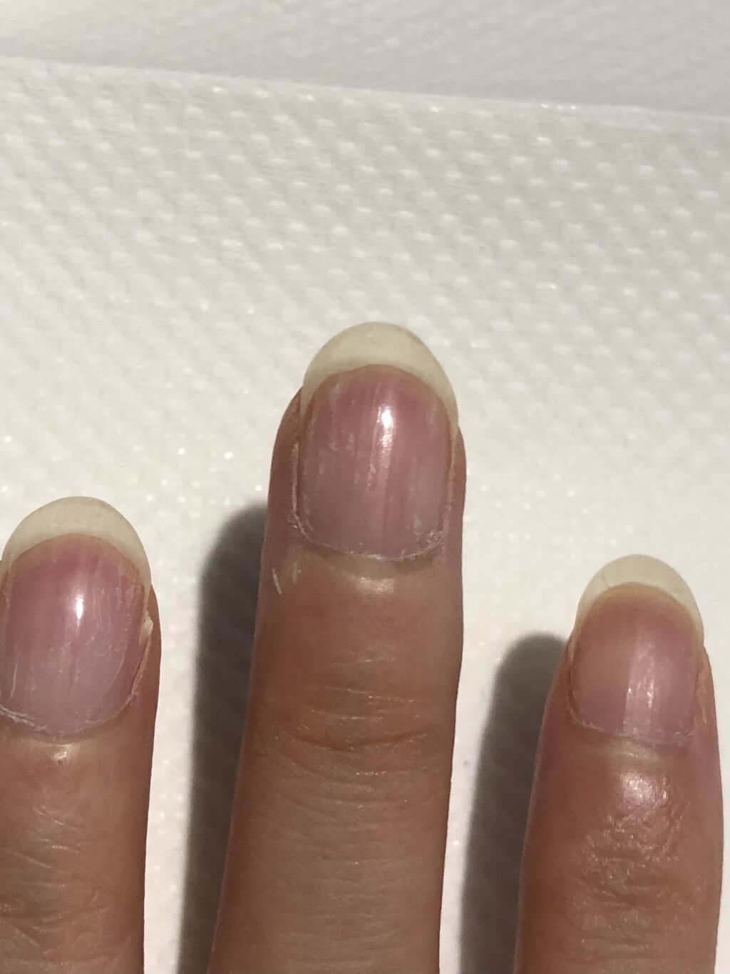 ウィンマックス クイックドライ トップコート/DAISO/ネイルトップコートを使ったクチコミ（2枚目）