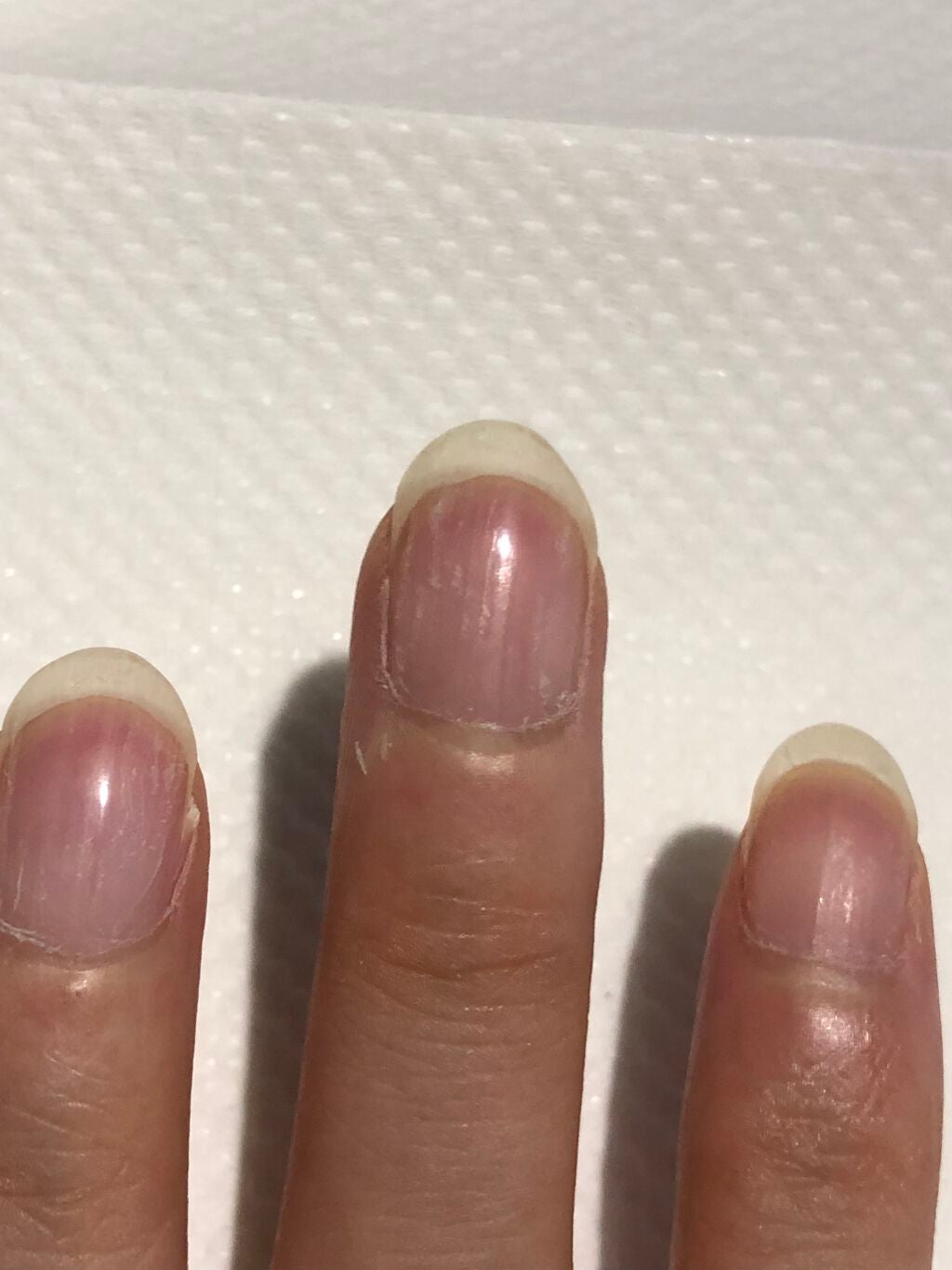 ウィンマックス クイックドライ トップコート/DAISO/ネイルトップコートを使ったクチコミ(2枚目)