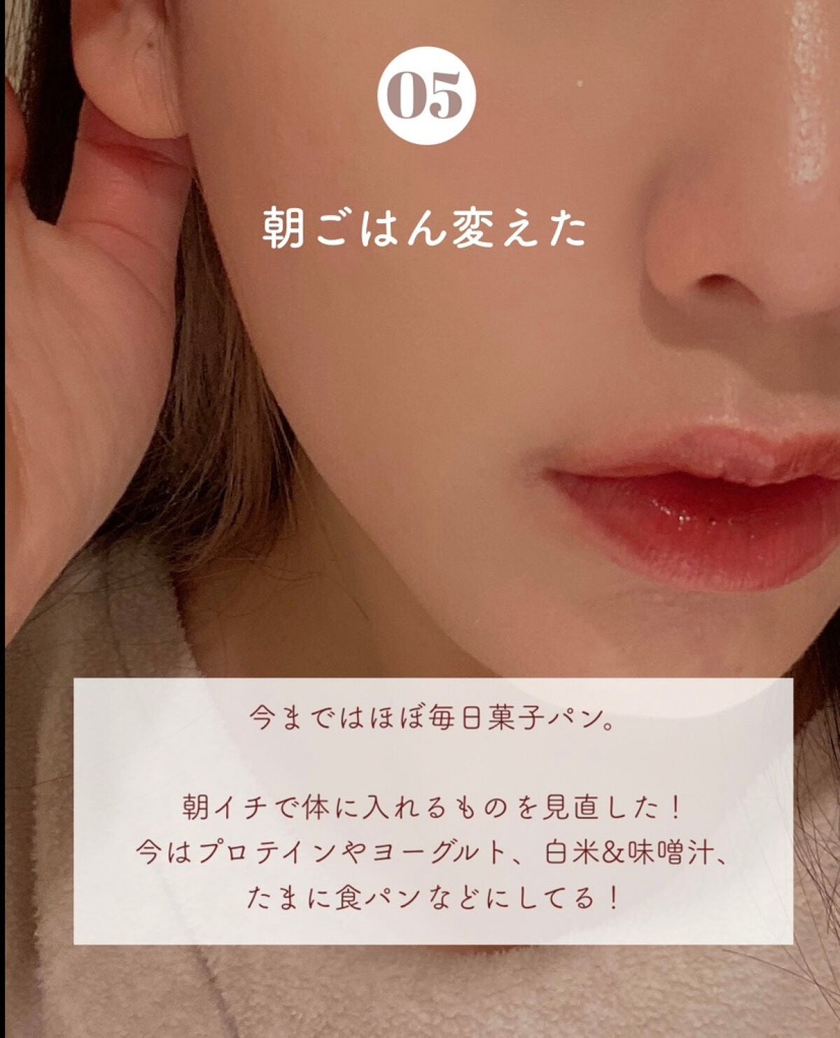 セラミドスキンケア 薬用アクネVCローション/エトヴォス/化粧水を使ったクチコミ(6枚目)