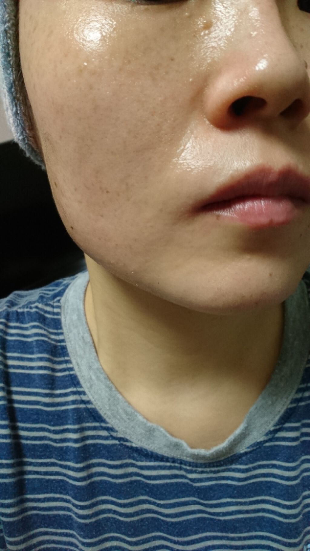 とろんと濃ジェル 薬用美白/なめらか本舗/オールインワン化粧品を使ったクチコミ（1枚目）