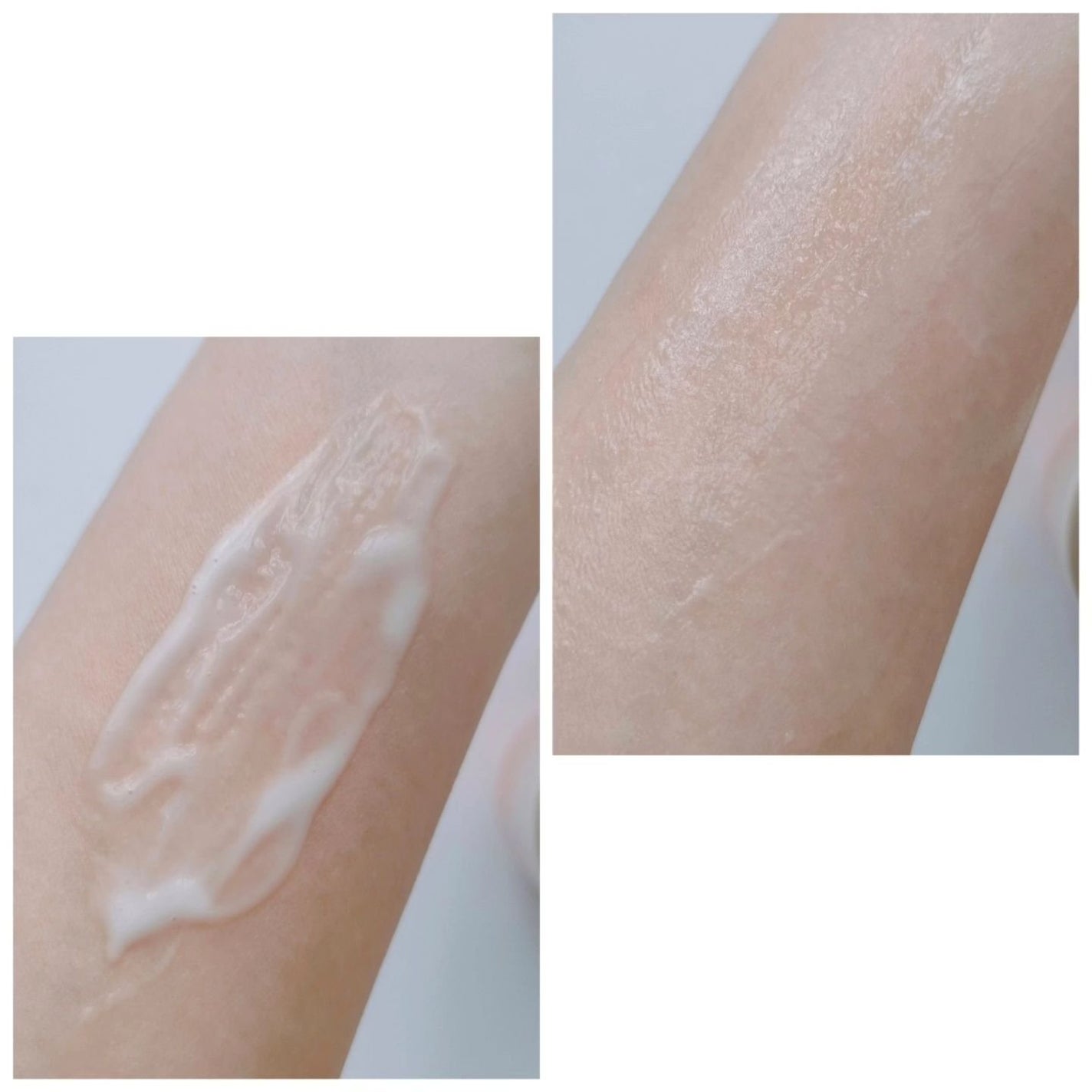 vitoas(ビトアス) マイパーフェクション I しっとり/vitoas/美容液を使ったクチコミ(5枚目)