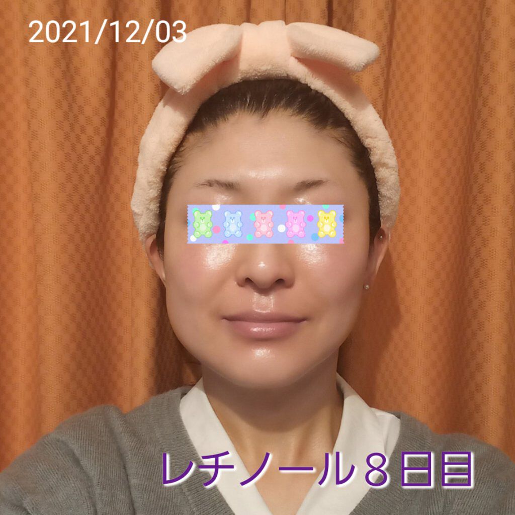 スーパーリンクルセラムVA/KISO/美容液を使ったクチコミ（1枚目）