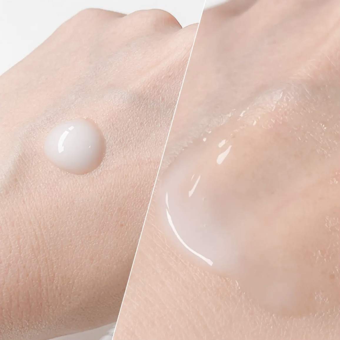 リードルショット300/VT/美容液を使ったクチコミ（2枚目）