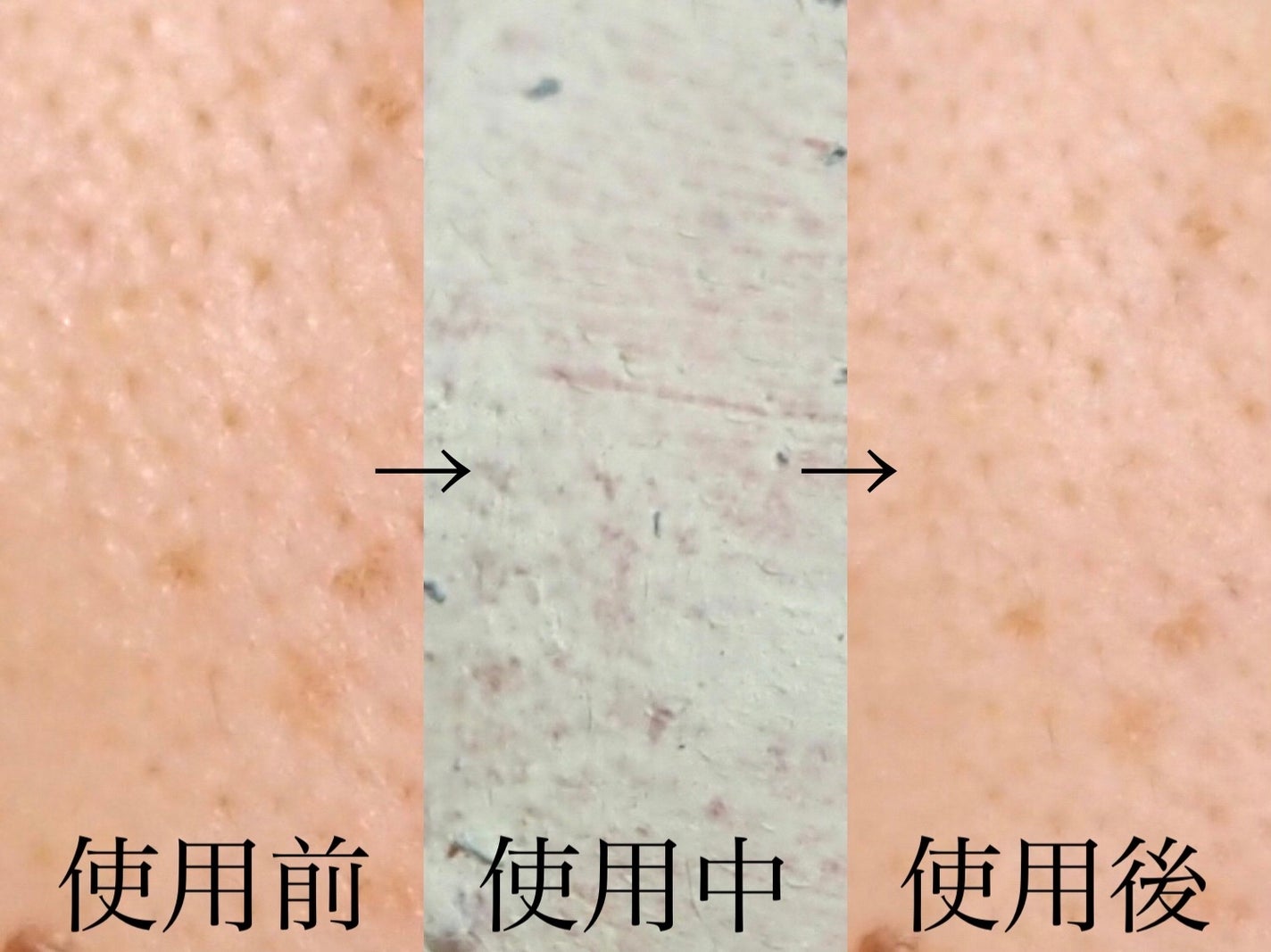 グリーントマトクレイマスククレンザー/FULLY/洗い流すパック・マスクを使ったクチコミ(4枚目)