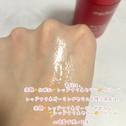 レッドアクネセラム/MEDICUBE/美容液を使ったクチコミ(5枚目)