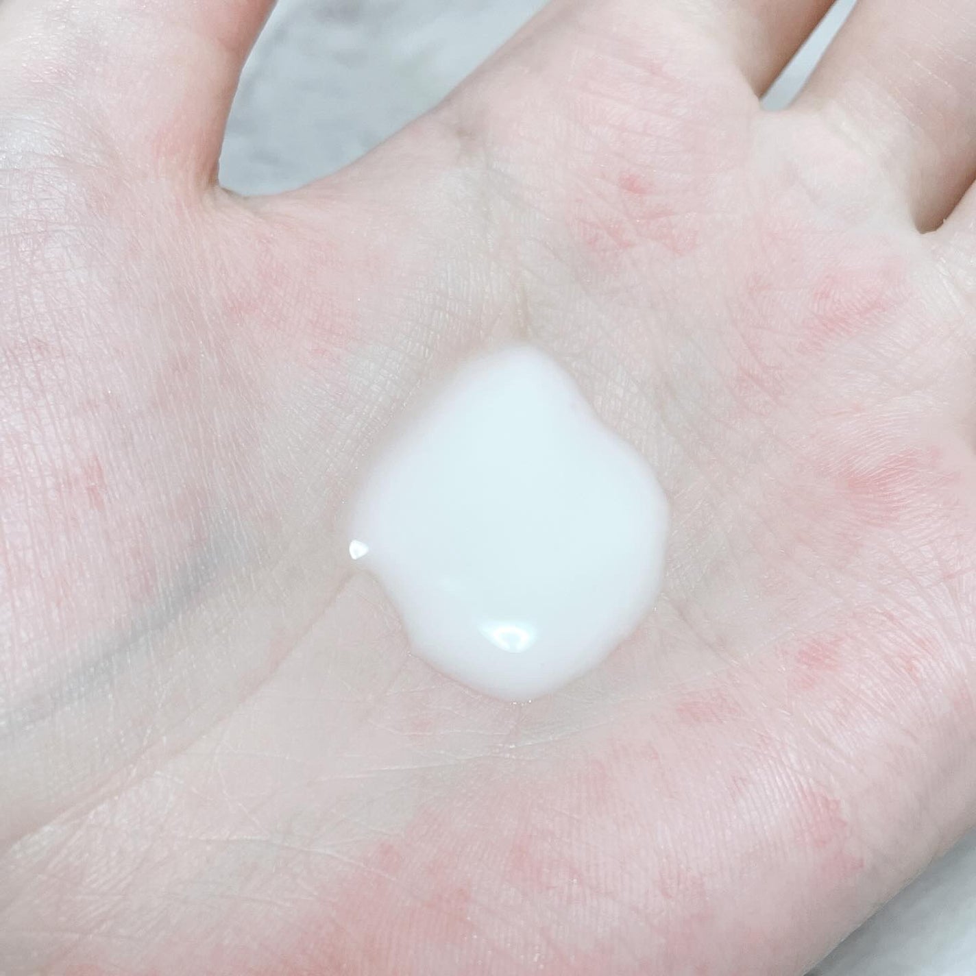 薬用ローション(しっとり)/IHADA/化粧水を使ったクチコミ(6枚目)