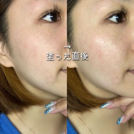 APRIAGEオイルS/AiB(エーアイビー)/ボディクリームを使ったクチコミ(5枚目)