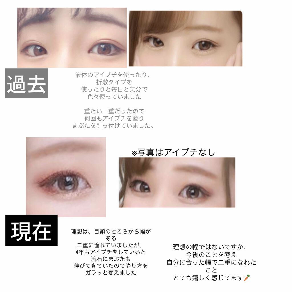 アイビューティー フィクサー WP/アストレア ヴィルゴ/二重まぶた用アイテムを使ったクチコミ（2枚目）