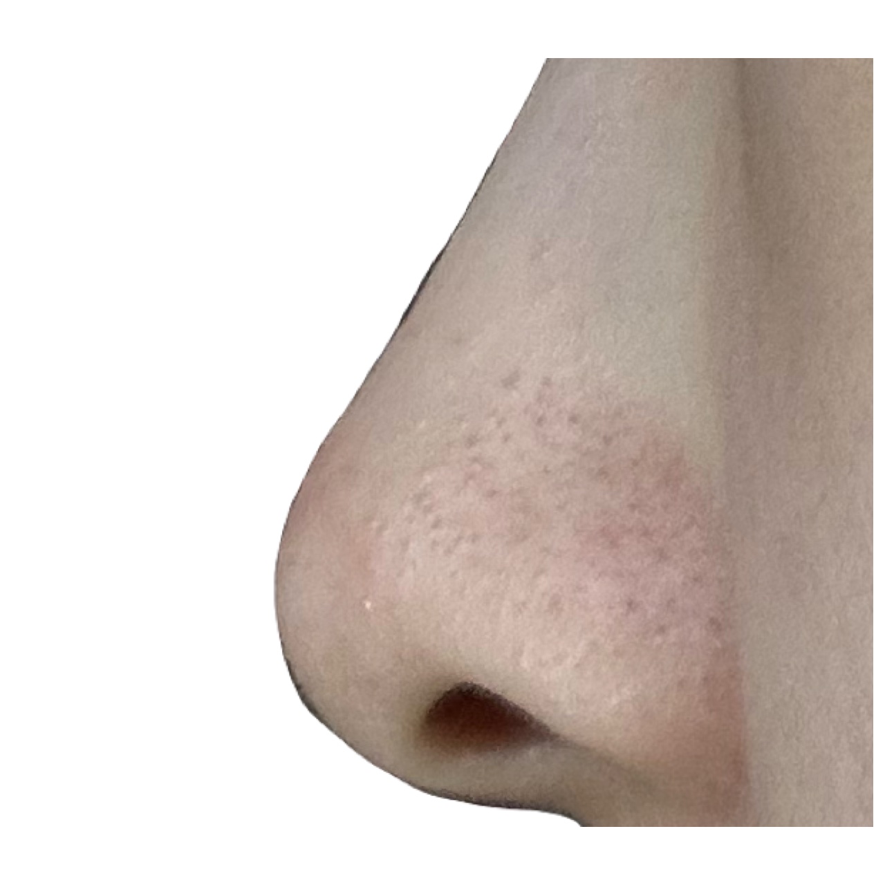 パーフェクトワンフォーカス スムースクレンジングバーム ディープブラック クロミ 限定デザイン（75g）/PERFECT ONE  FOCUS/クレンジングバームを使ったクチコミ（3枚目）